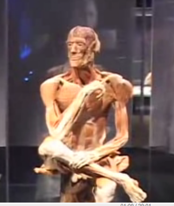 Plastination